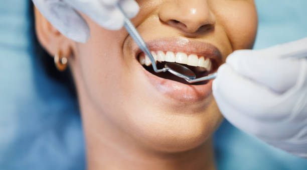 Best Weekend Emergency Dental Services in Mitchell, IN