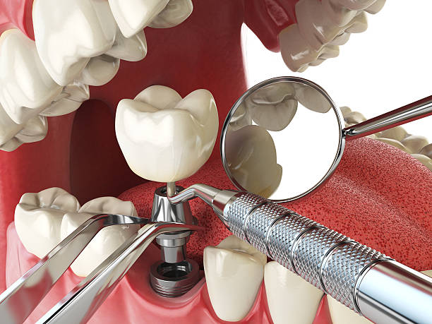 Best Emergency Care for Gum Disease in Mitchell, IN